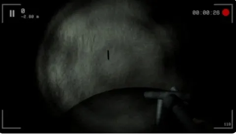 SCP087��Ԩ2026���°汾v1.0.2.1 �ֻ���